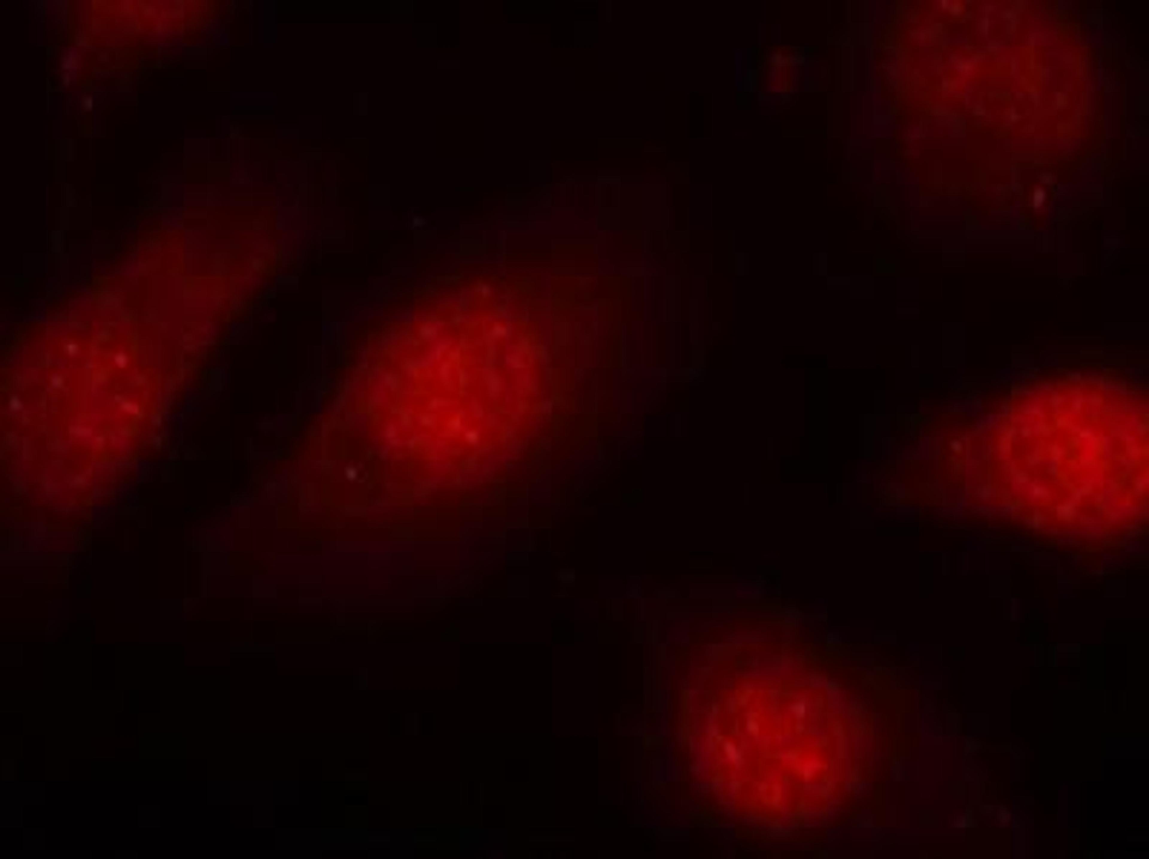 Immunocytochemistry/Immunofluorescence: RB1 [p Ser780] Antibody [NB100-82175] - Staining of methanol-fixed Hela cells using RB1 [p Ser780] Antibody