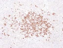 Detection of human Stomatin by immunohistochemistry.