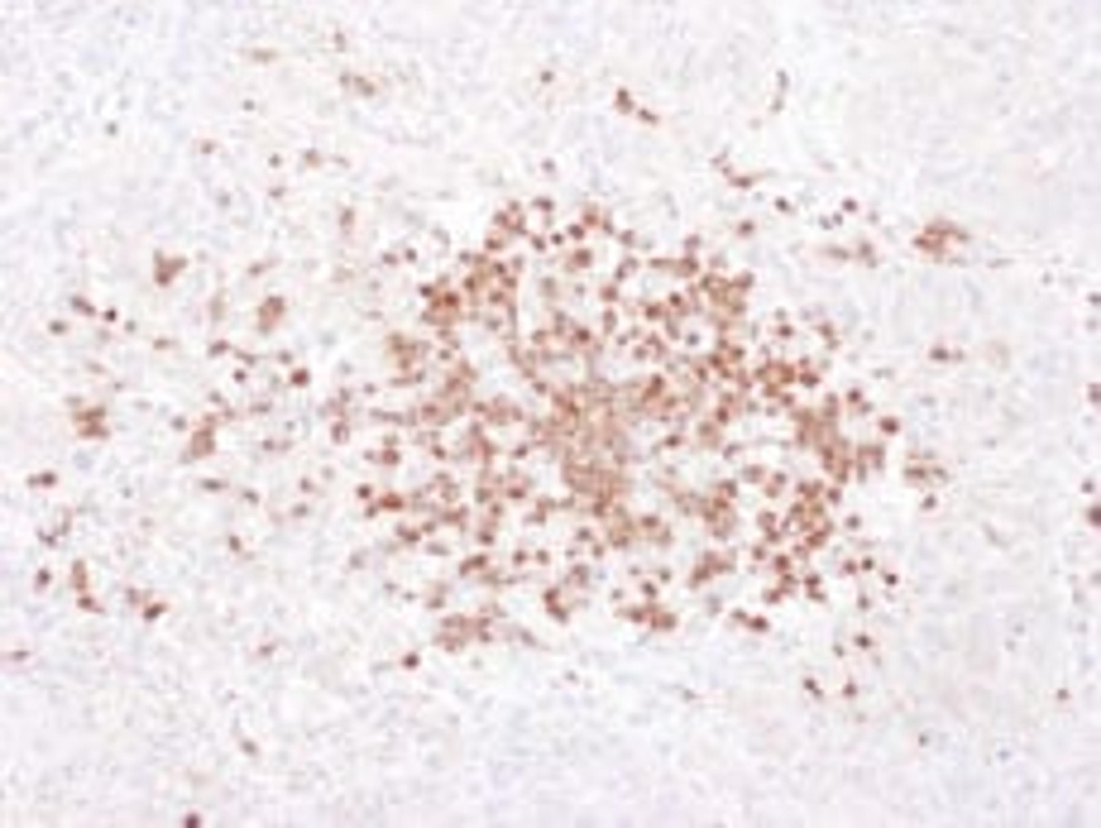 Detection of human Stomatin by immunohistochemistry.