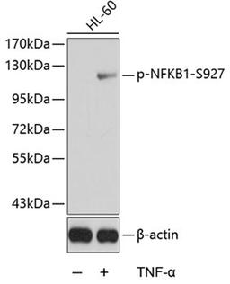 Western blot - Phospho-NFKB1-S927 antibody (AP0264)