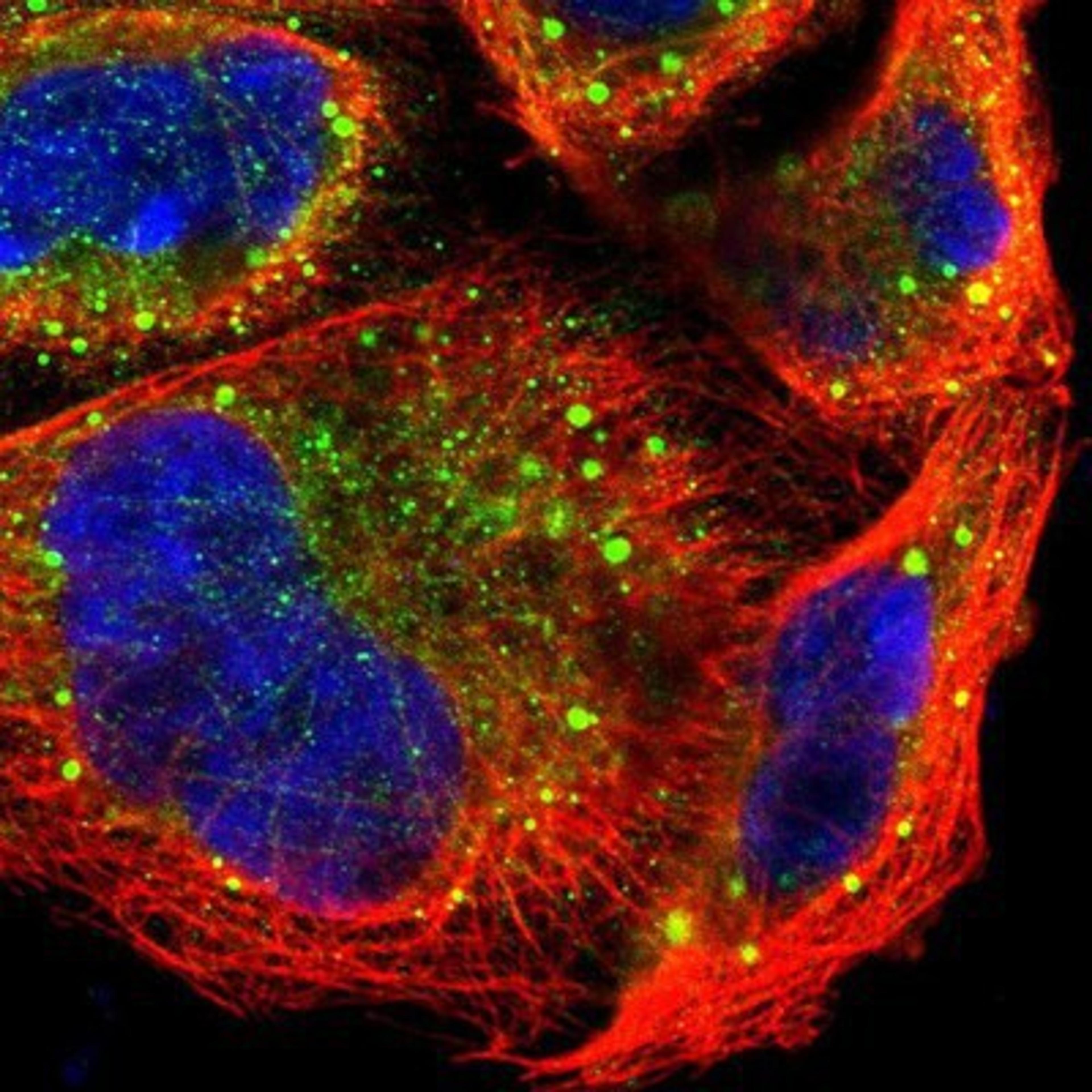 Immunocytochemistry/Immunofluorescence: PREX1 Antibody [NBP1-93590] Staining of human cell line A-431 shows positivity in cytoplasm & vesicles.