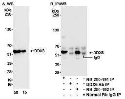 Detection of human DDX6 on HeLa whole cell lysate using NB200-192. DDX6 was also IPed using rabbit anti-DDX6 antibody NB200-191, but not with 'DDX6 Ab', which is to another epitope from DDX6. Normal rabbit IgG was used as a negative control.