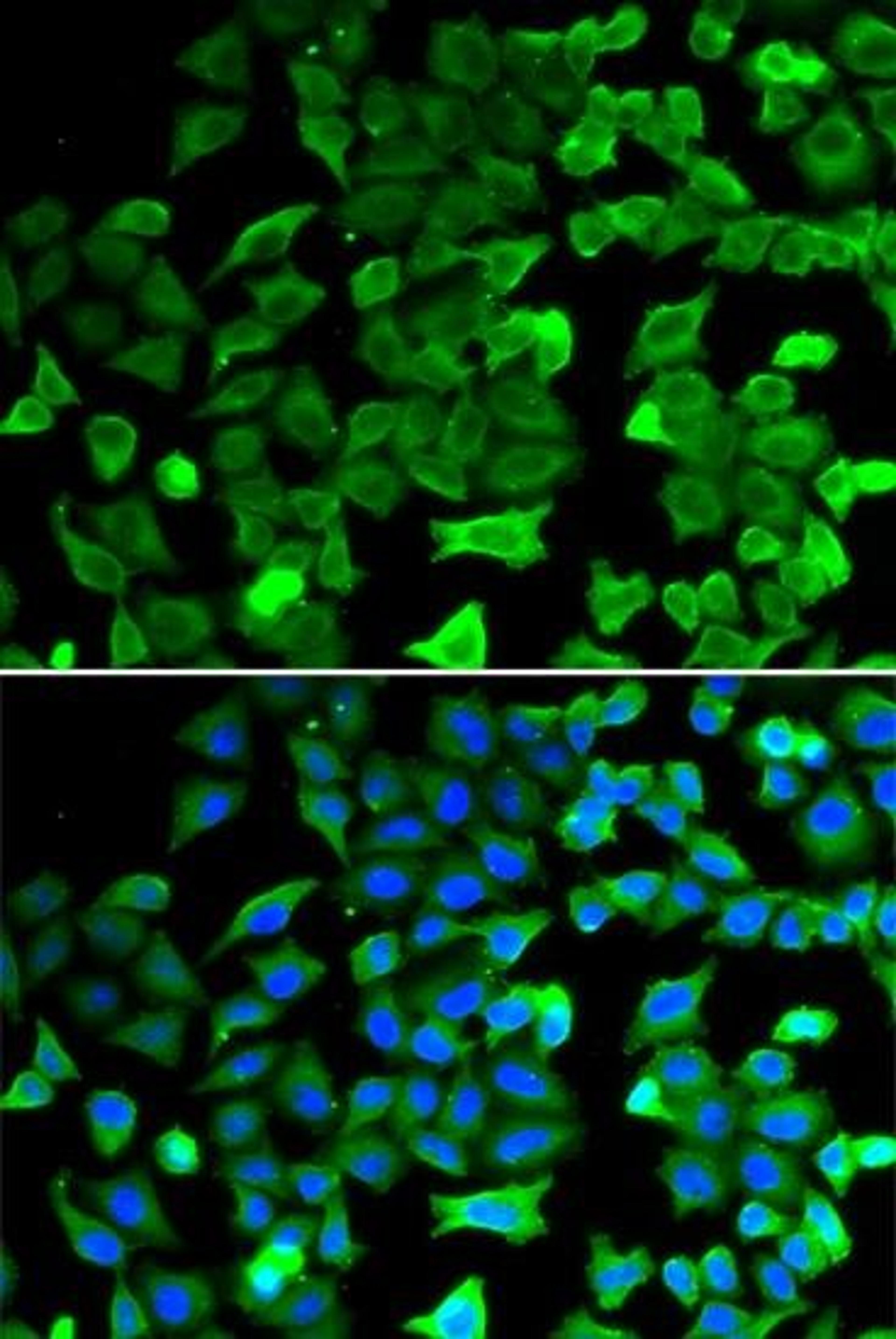 Immunofluorescense analysis of hela cell using SIRT2 antibody