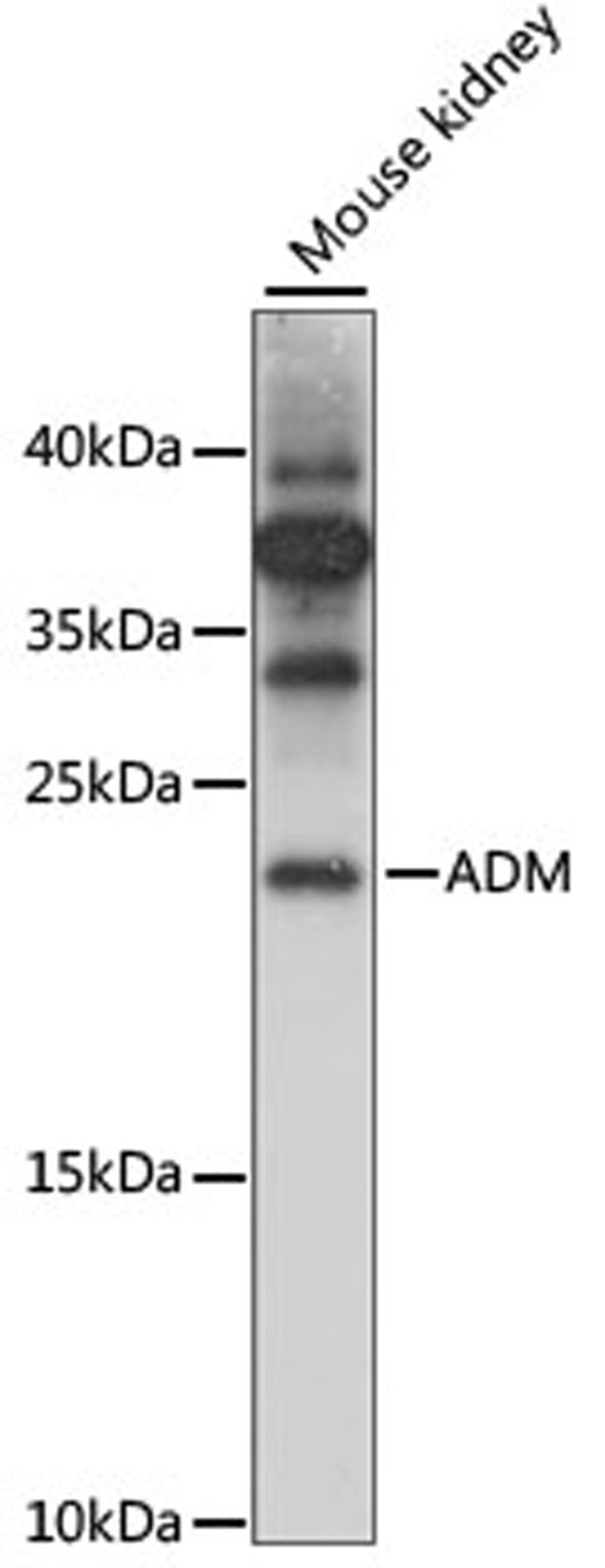 Western blot - ADM antibody (A8659)