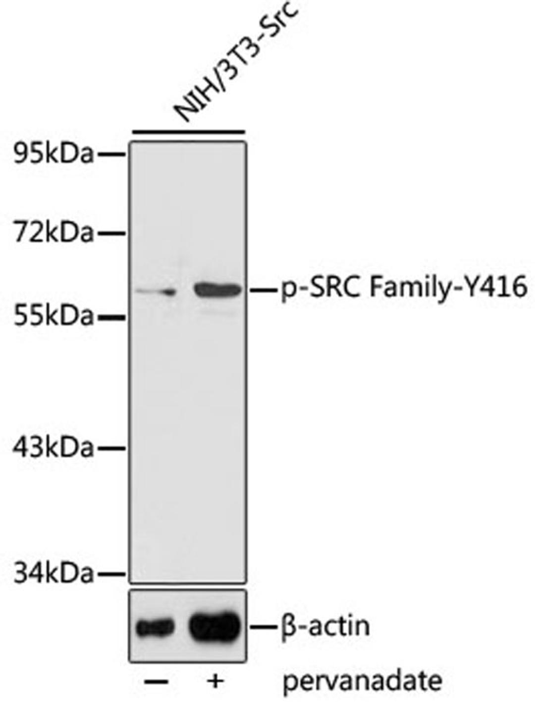 Western blot - Phospho-SRC Family-Y416 antibody (AP0480)