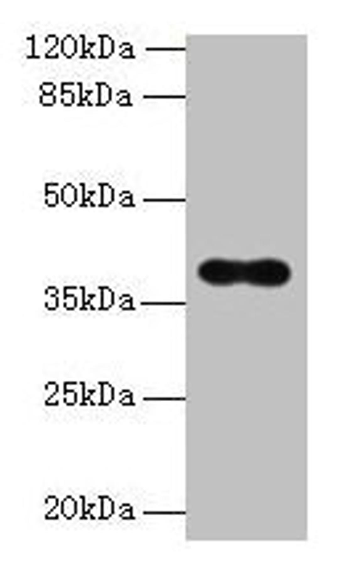Western blot. All lanes: OGG1 antibody at 6µg/ml + Hela whole cell lysate. Secondary. Goat polyclonal to rabbit IgG at 1/10000 dilution. Predicted band size: 39, 37, 46, 48, 40, 23, 41 kDa. Observed band size: 39 kDa
