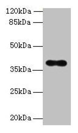 Western blot. All lanes: OGG1 antibody at 6µg/ml + Hela whole cell lysate. Secondary. Goat polyclonal to rabbit IgG at 1/10000 dilution. Predicted band size: 39, 37, 46, 48, 40, 23, 41 kDa. Observed band size: 39 kDa