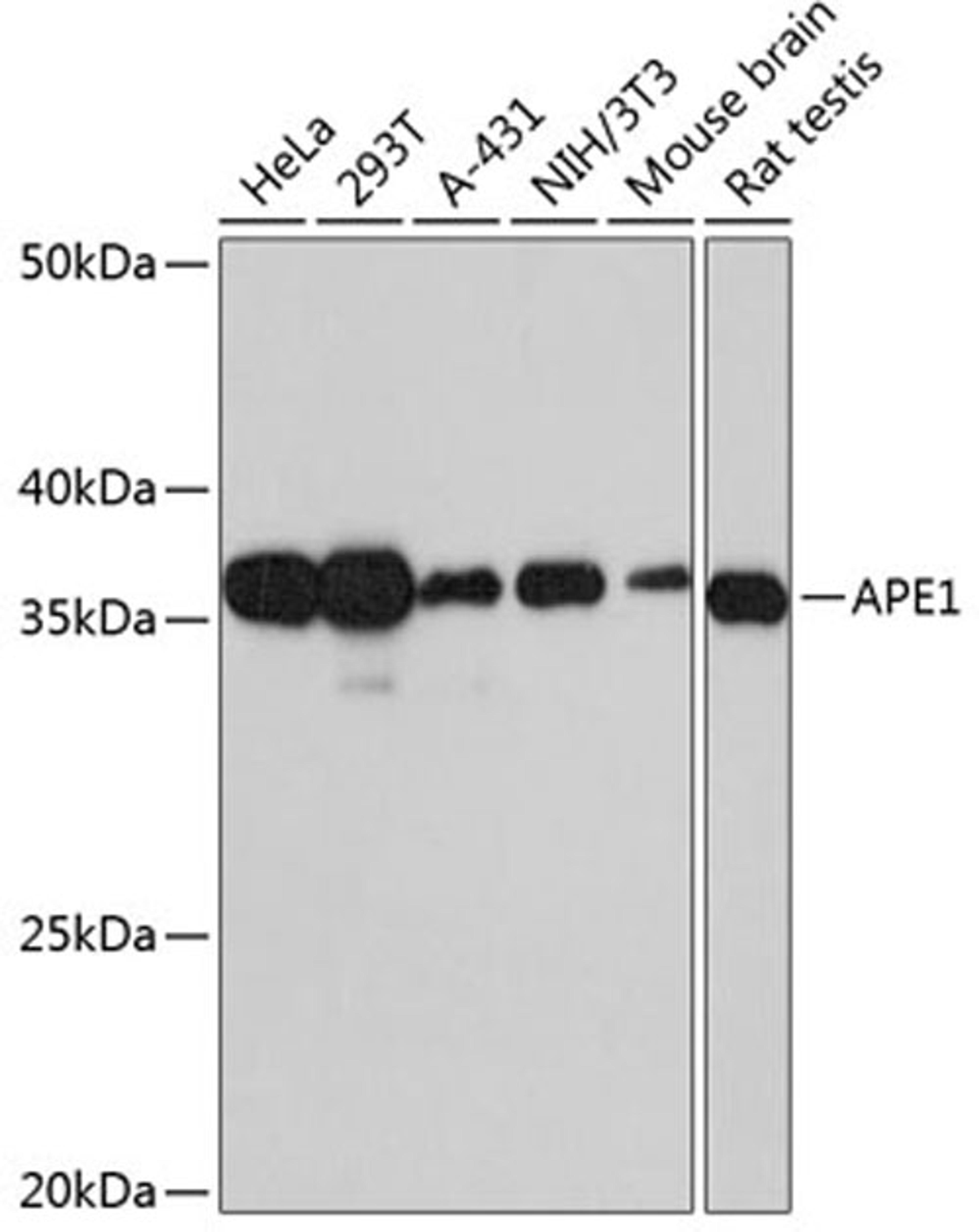 Western blot - APE1 Rabbit mAb (A11238)