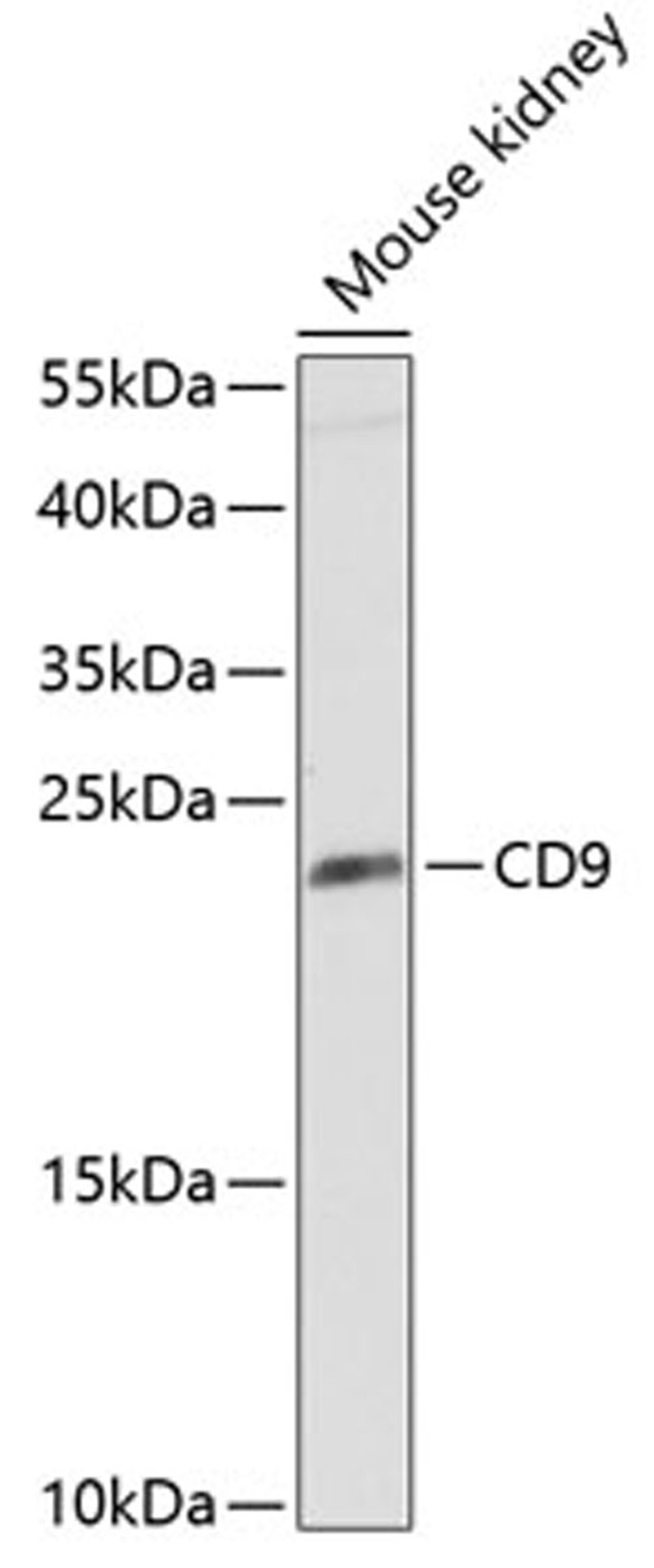 Western blot - CD9 Antibody (A1703)