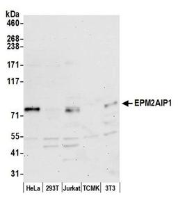 Detection of human and mouse EPM2AIP1 by WB.