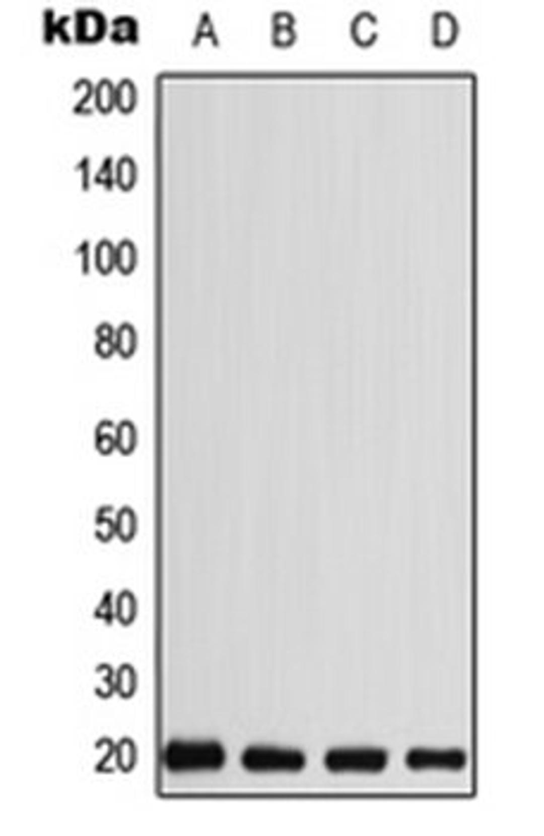 Western blot analysis of MDMB435 (Lane 1), HEK293T (Lane 2), SP2/0 (Lane 3), H9C2 (Lane 4) whole cell lysates using CABP5 antibody