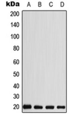 Western blot analysis of MDMB435 (Lane 1), HEK293T (Lane 2), SP2/0 (Lane 3), H9C2 (Lane 4) whole cell lysates using CABP5 antibody