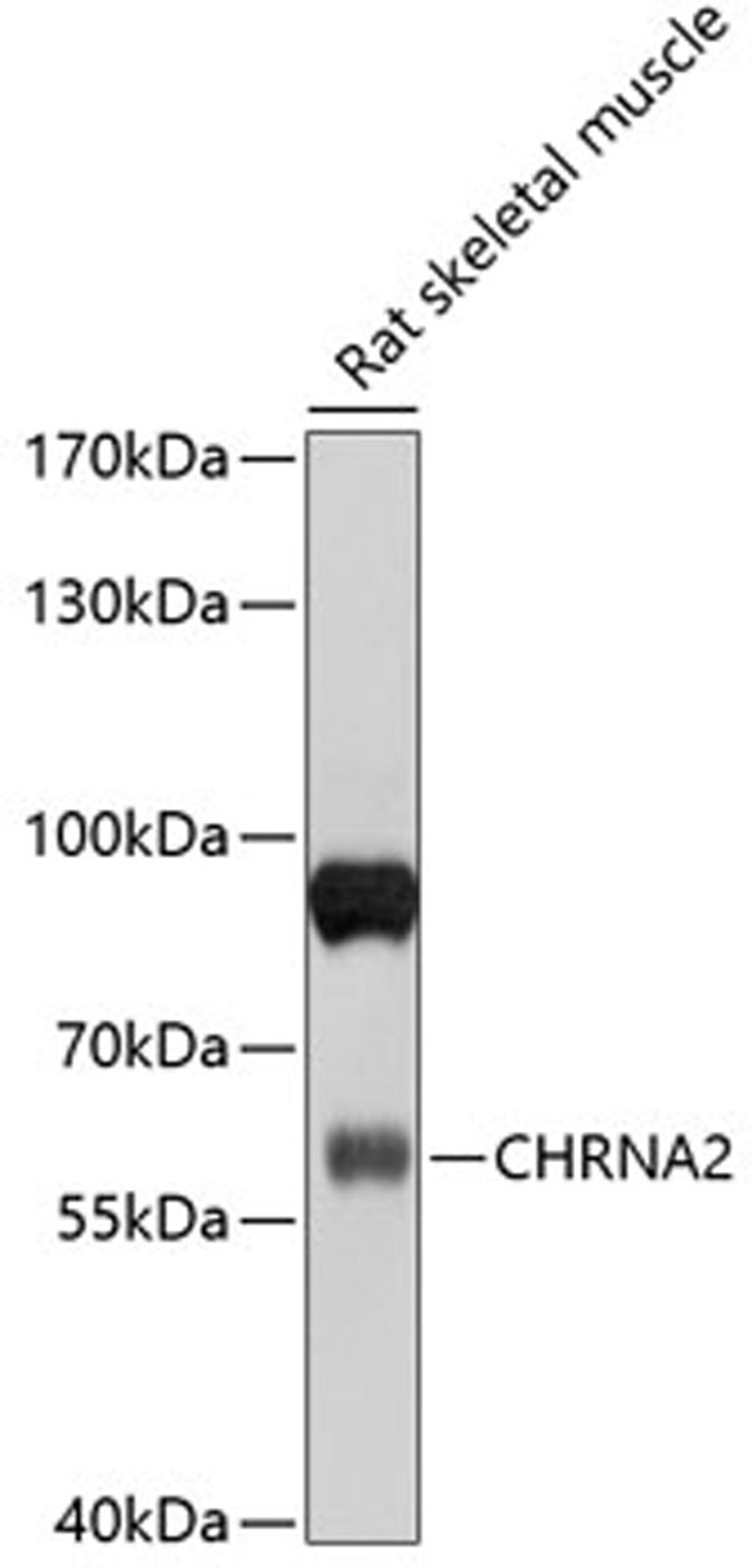 Western blot - CHRNA2 antibody (A10056)