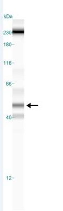 Simple Western: LXR Antibody [NB400-157] - Simple Western lane view shows a ~49 kDa for LXR in human skeletal muscle tissue lysate under reducing conditions. Image from verified customer review.