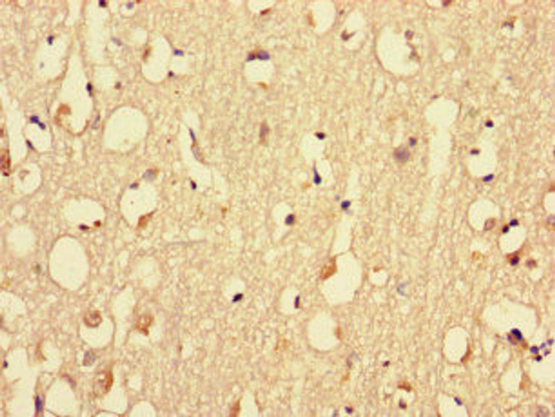 Immunohistochemistry of paraffin-embedded human brain tissue using CSB-PA015297LA01HU at dilution of 1:100