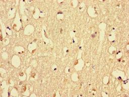 Immunohistochemistry of paraffin-embedded human brain tissue using CSB-PA015297LA01HU at dilution of 1:100