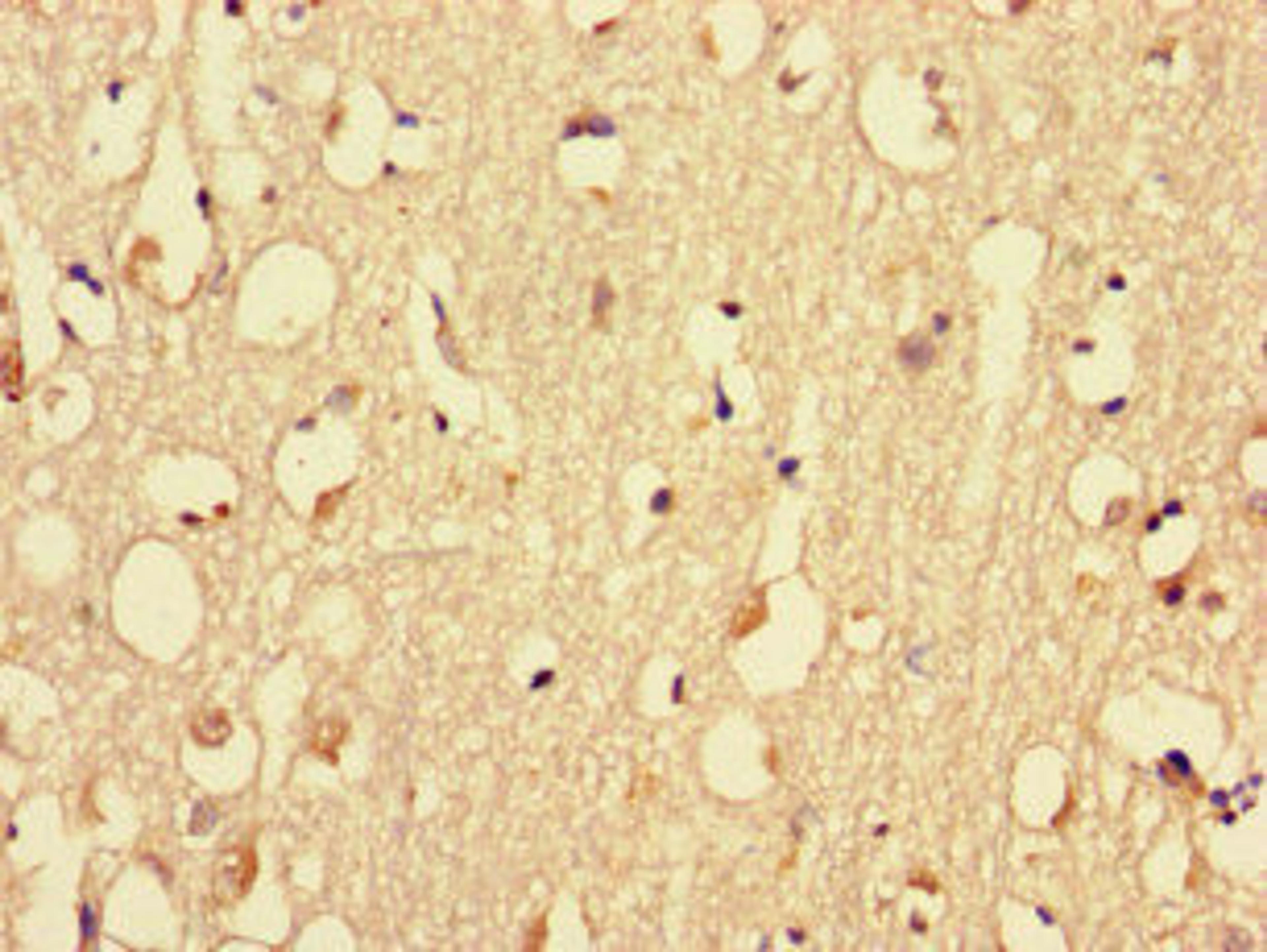 Immunohistochemistry of paraffin-embedded human brain tissue using CSB-PA015297LA01HU at dilution of 1:100