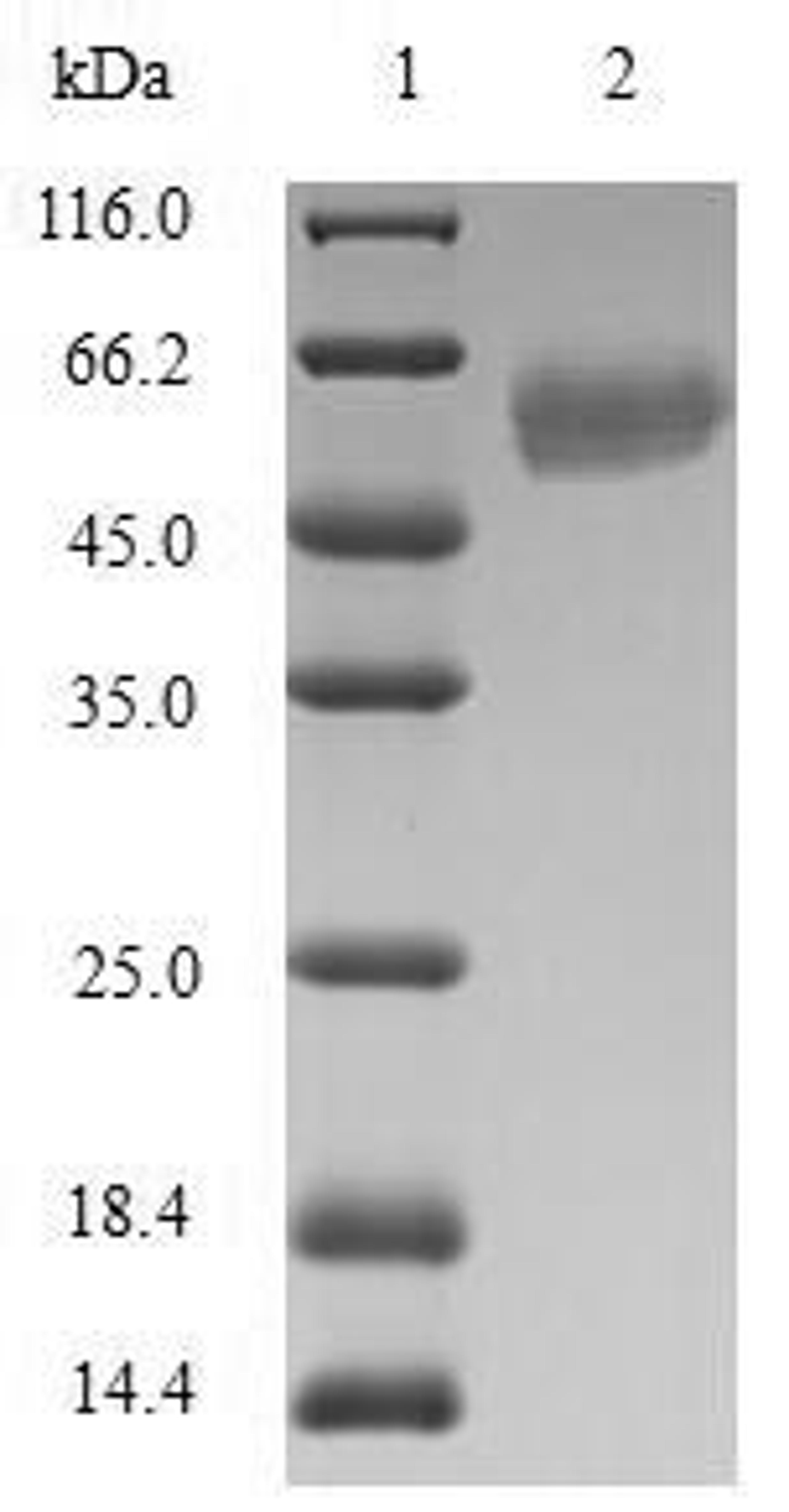 (Tris-Glycine gel) Discontinuous SDS-PAGE (reduced) with 5% enrichment gel and 15% separation gel.