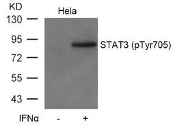 Western blot analysis of extracts from Hela cells untreated or treated with IFN a using STAT3(Phospho-Tyr705) Antibody.