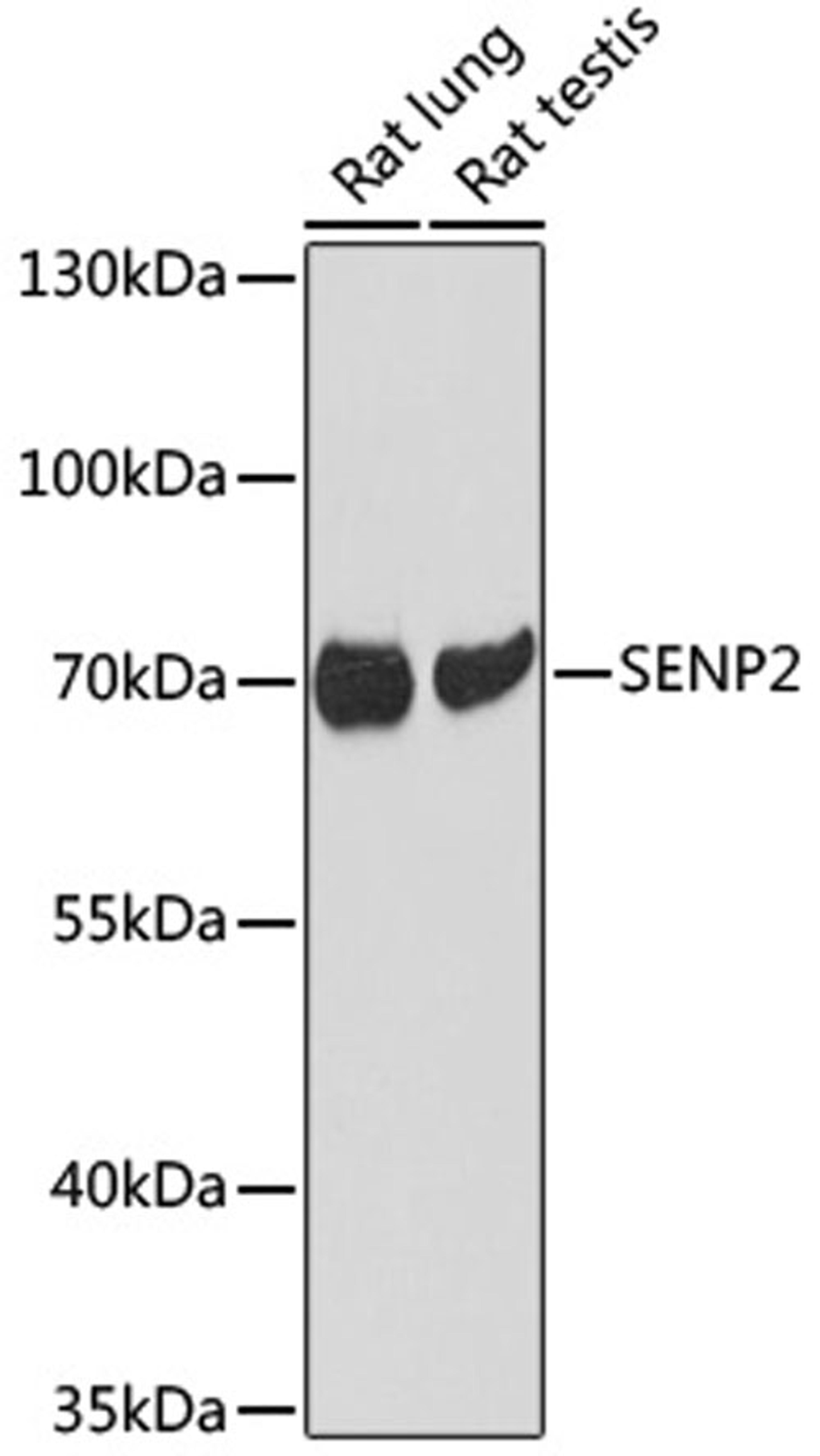 Western blot - SENP2 antibody (A17994)