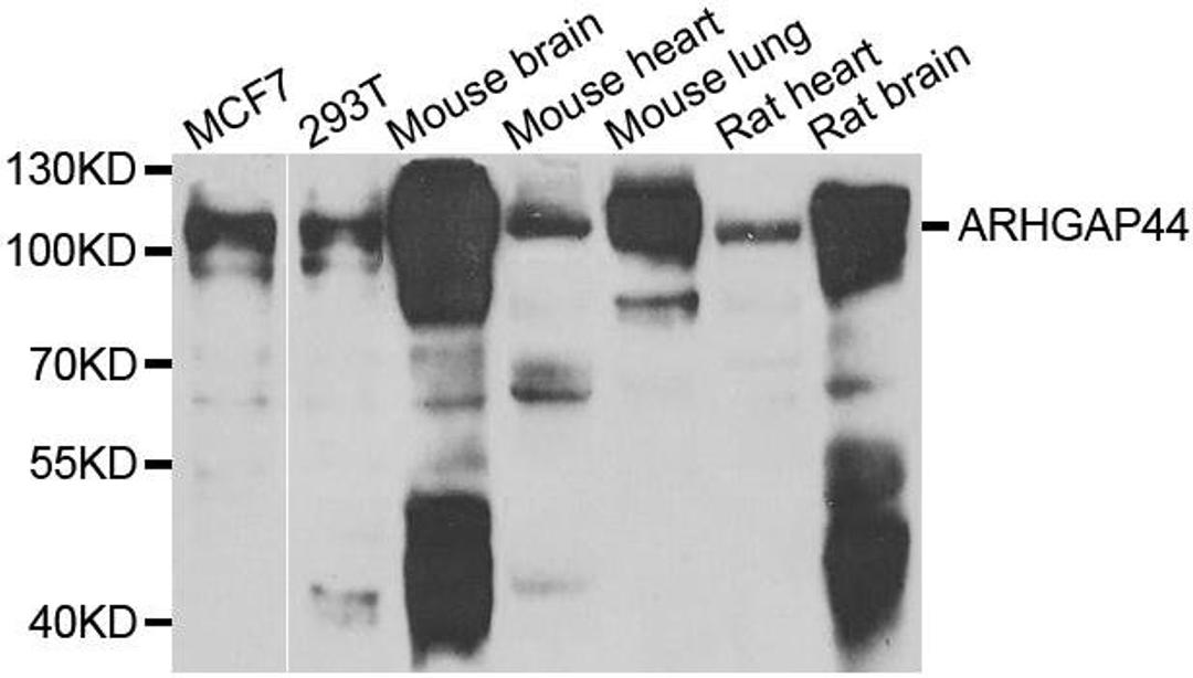 Western blot analysis of extracts of various cell lines using ARHGAP44 antibody