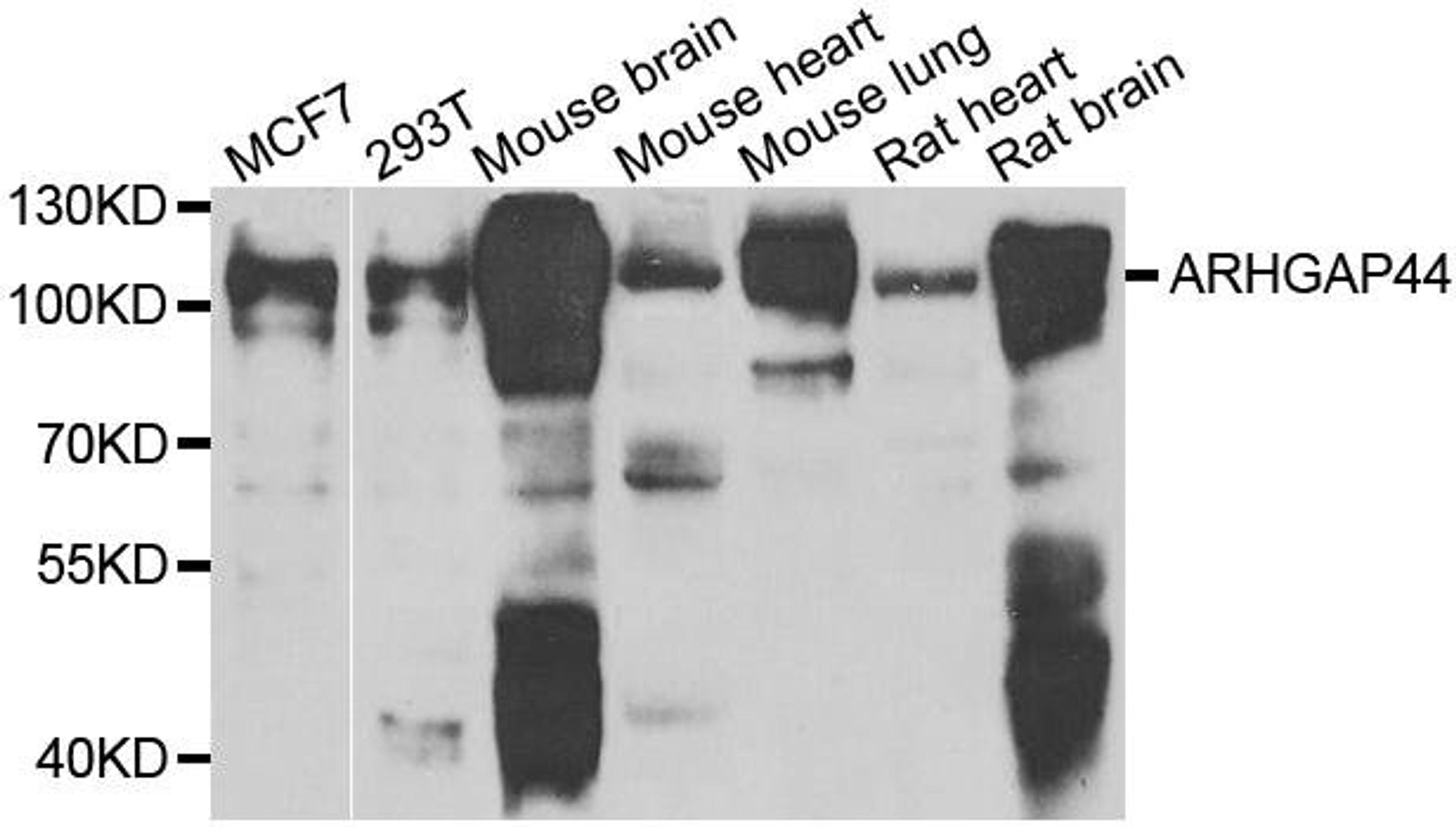 Western blot analysis of extracts of various cell lines using ARHGAP44 antibody