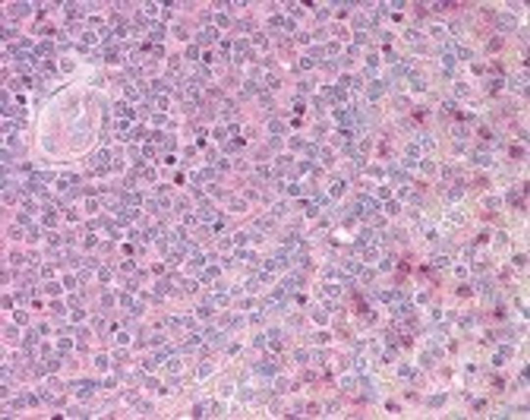 Immunohistochemistry staining of ST5 in spleen (formalin-fixed paraffin embedded) tissue using ST5 Antibody.