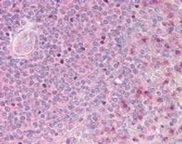 Immunohistochemistry staining of ST5 in spleen (formalin-fixed paraffin embedded) tissue using ST5 Antibody.