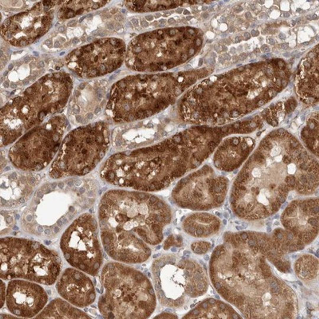 Immunohistochemistry-Paraffin: RANBP17 Antibody [NBP1-91029] - Staining of human kidney shows strong cytoplasmic positivity in tubular cells.