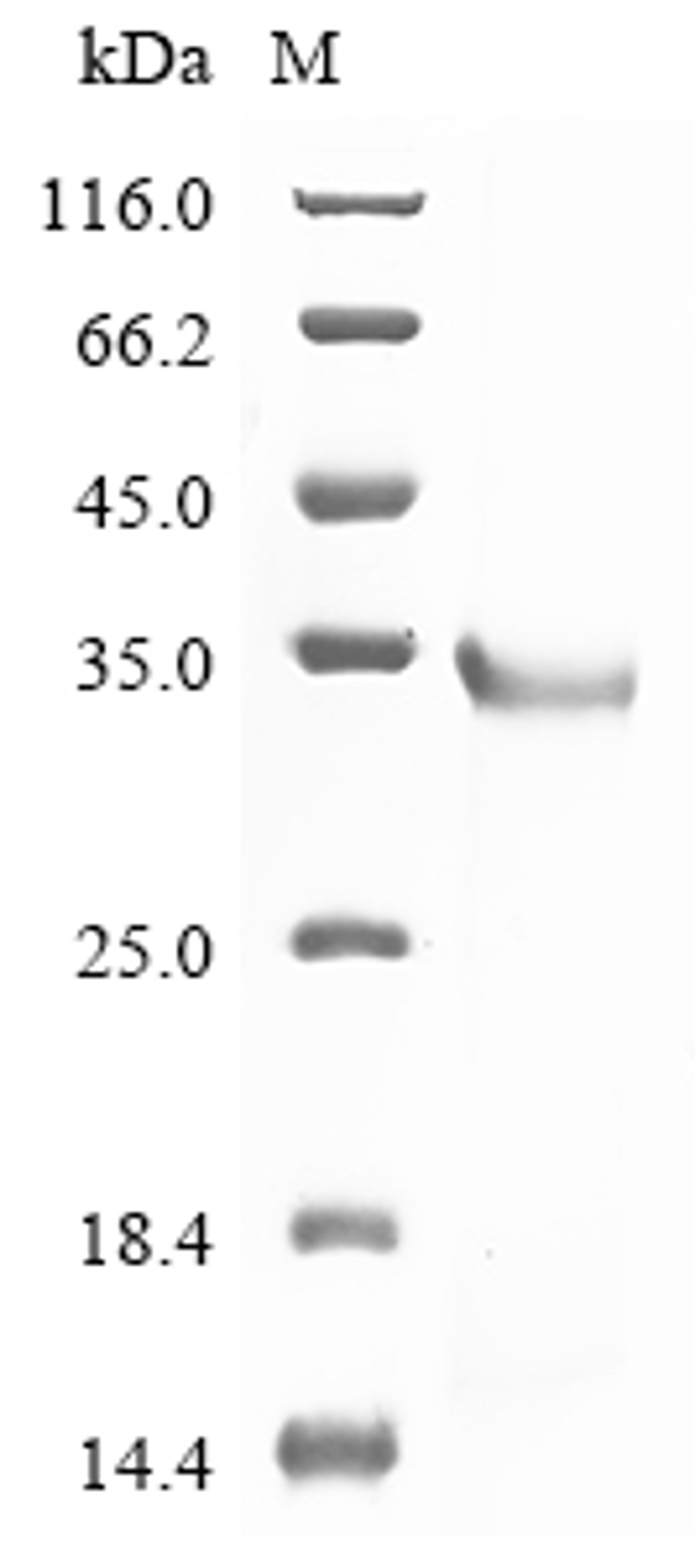 (Tris-Glycine gel) Discontinuous SDS-PAGE (reduced) with 5% enrichment gel and 15% separation gel.