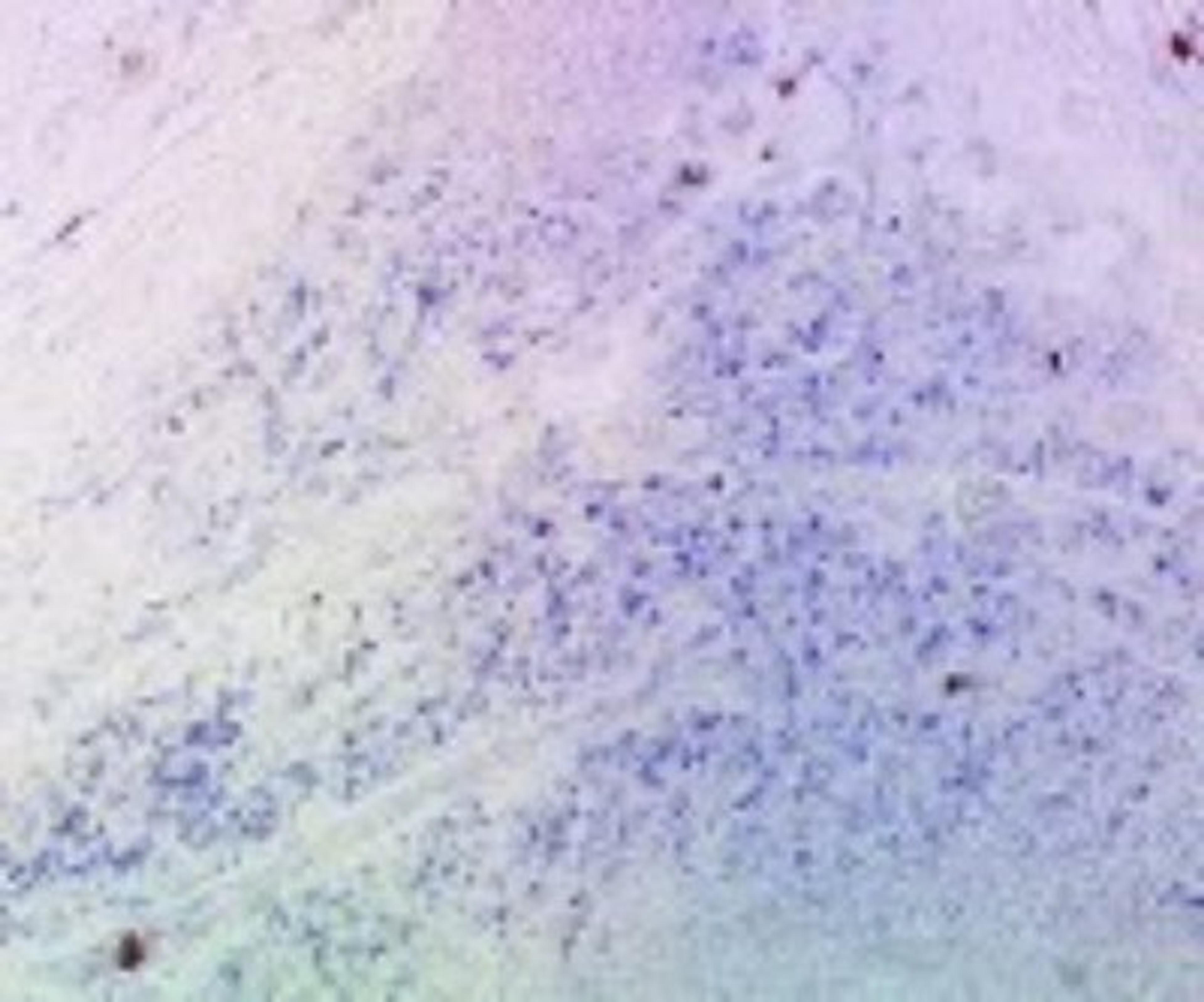 Immunohistochemistry-Frozen: DC-SIGN/CD209 Antibody (102E11.06) [DDX0202P-100] - Analysis using the Biotin conjugate of DDX0202P-100. Staining of human tonsil frozen section.