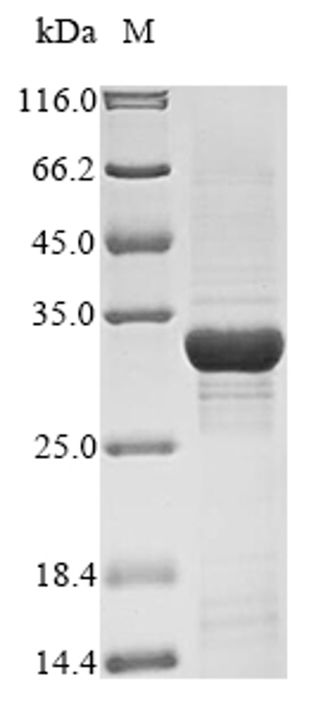 (Tris-Glycine gel) Discontinuous SDS-PAGE (reduced) with 5% enrichment gel and 15% separation gel.