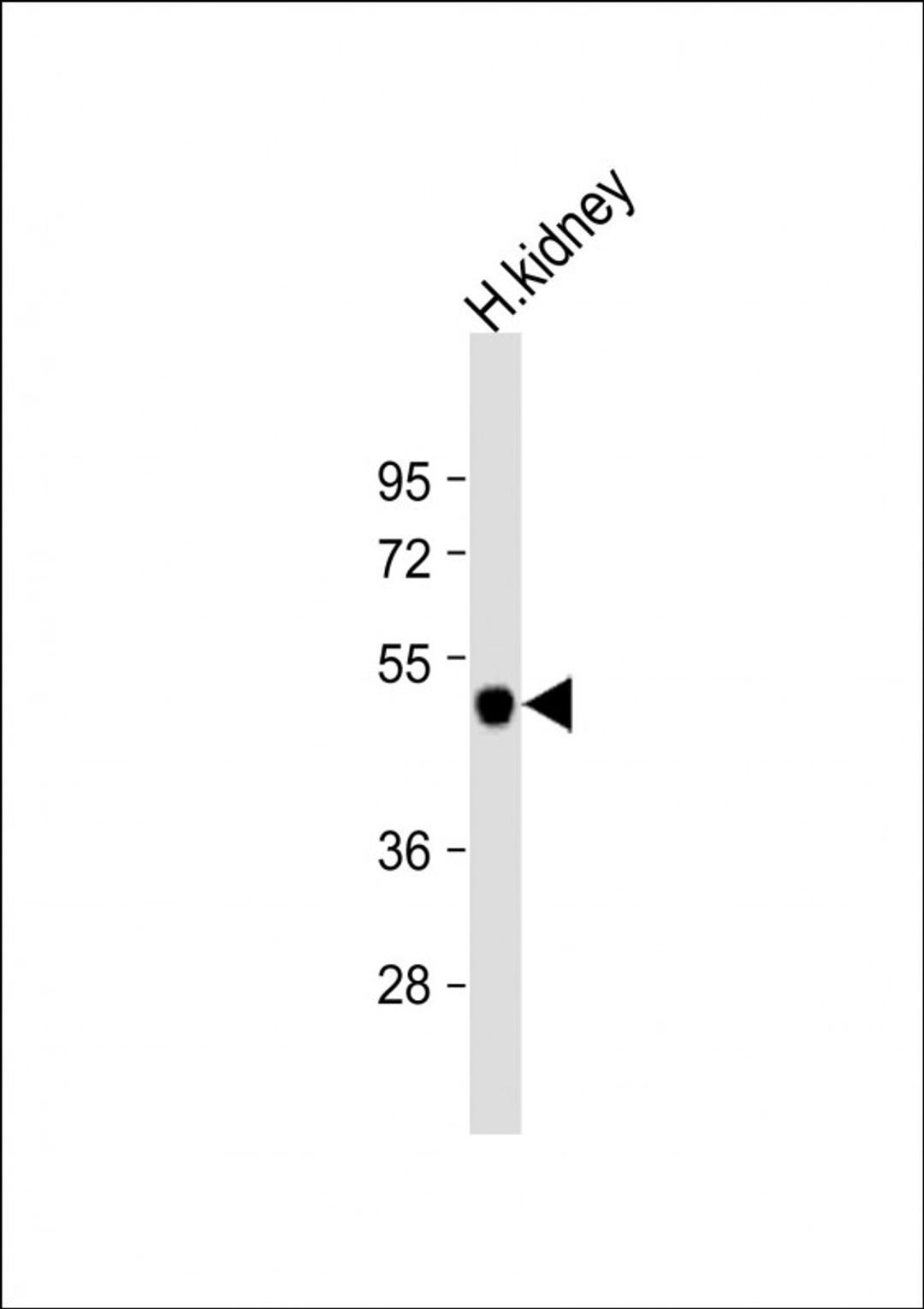 Western Blot at 1:1000 dilution + human kidney lysate Lysates/proteins at 20 ug per lane.