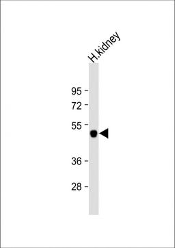 Western Blot at 1:1000 dilution + human kidney lysate Lysates/proteins at 20 ug per lane.