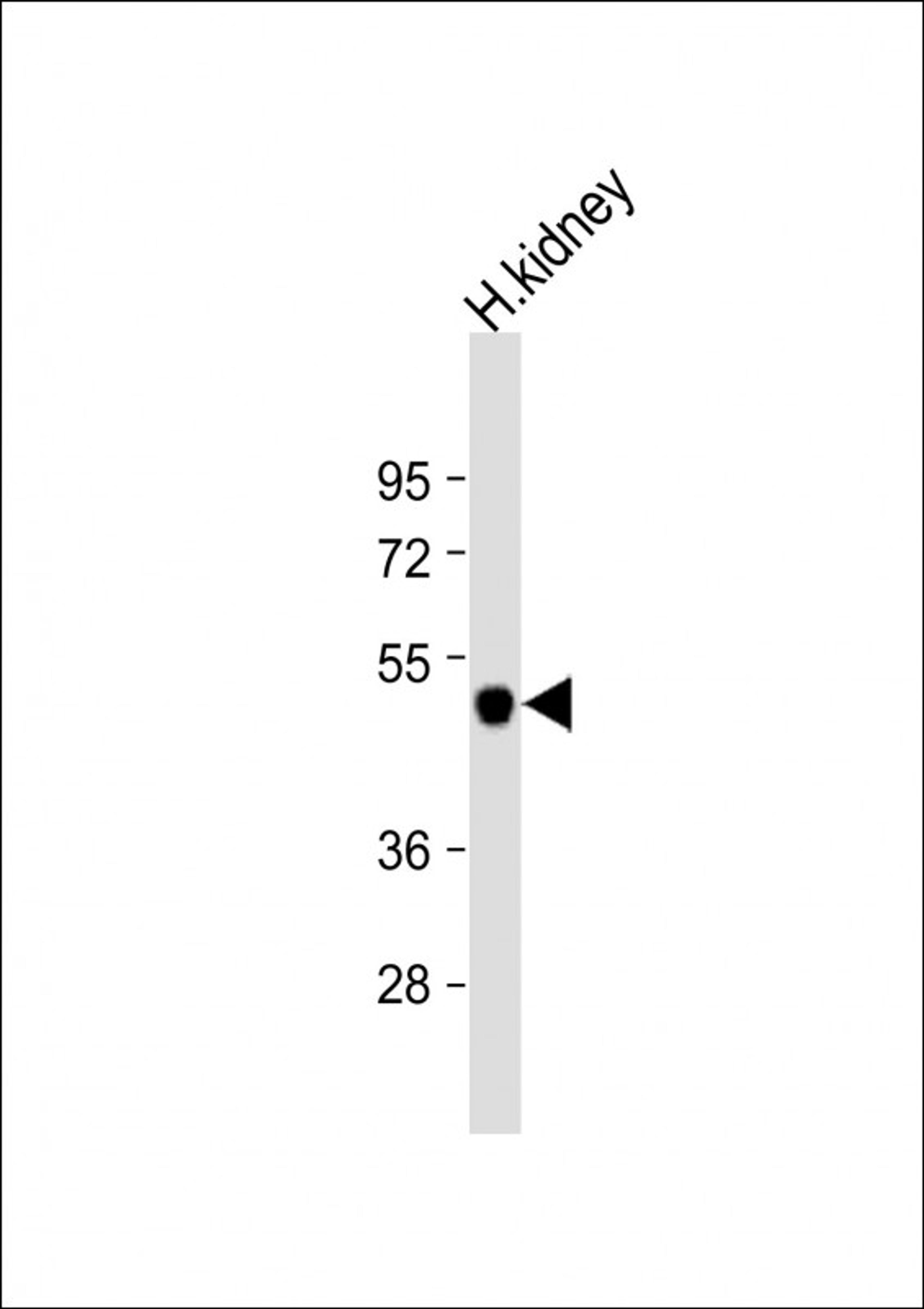 Western Blot at 1:1000 dilution + human kidney lysate Lysates/proteins at 20 ug per lane.