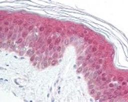 Immunohistochemistry staining of MAP2K2 in skin tissue using MAP2K2 Antibody.