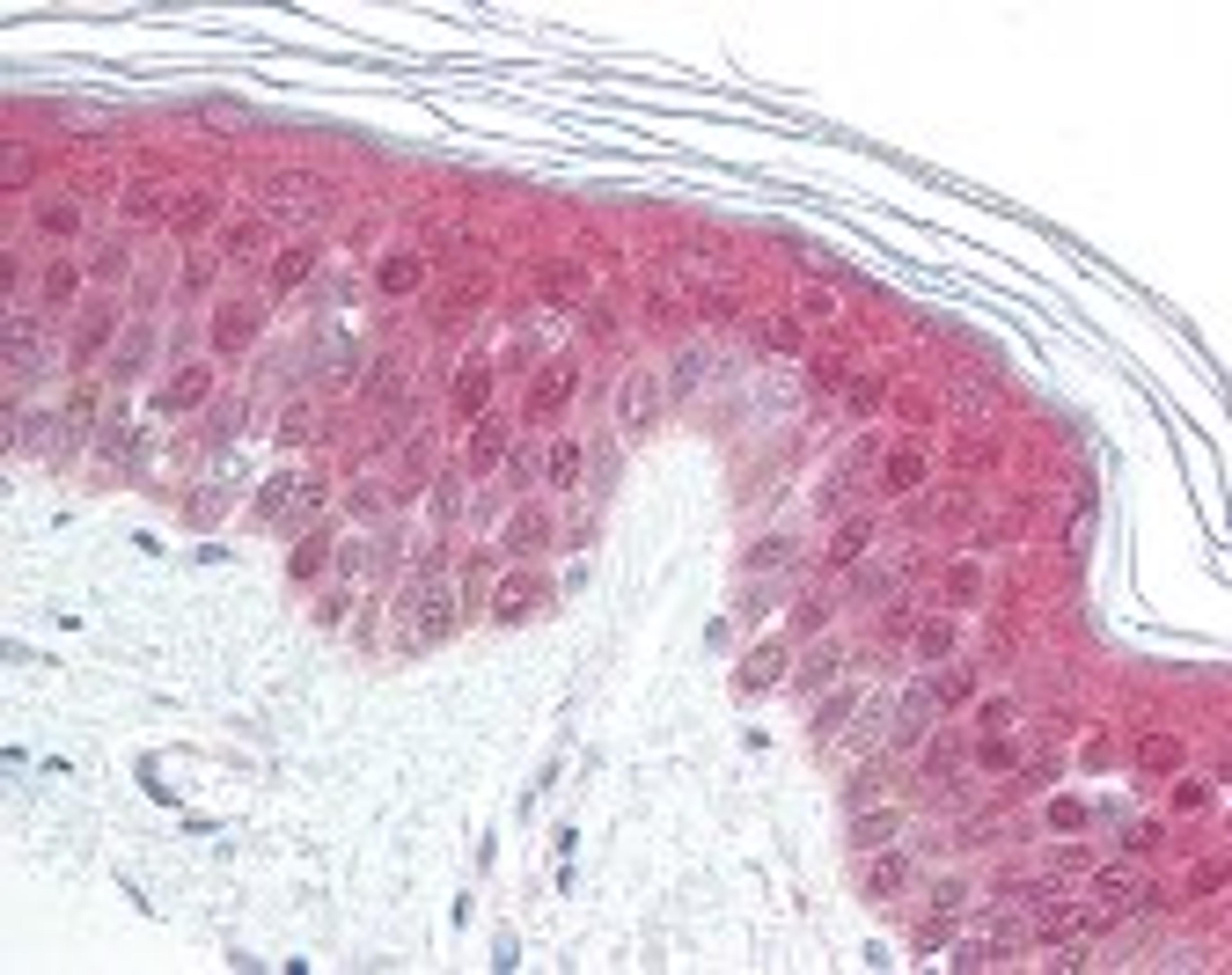 Immunohistochemistry staining of MAP2K2 in skin tissue using MAP2K2 Antibody.