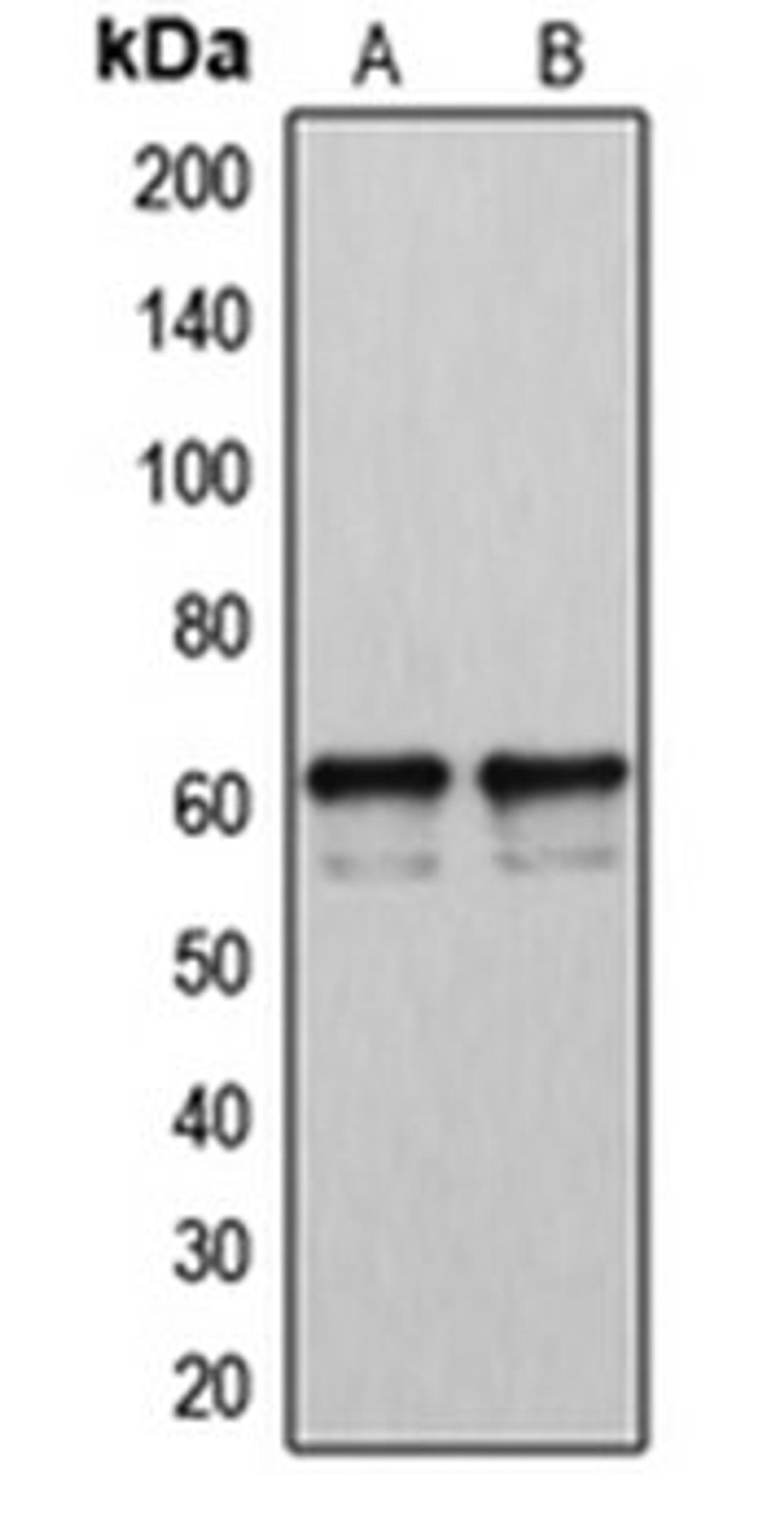 Western blot analysis of LOVO (Lane 1), A2058 (Lane 2) whole cell lysates using CYP2U1 antibody