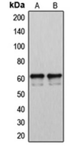 Western blot analysis of LOVO (Lane 1), A2058 (Lane 2) whole cell lysates using CYP2U1 antibody