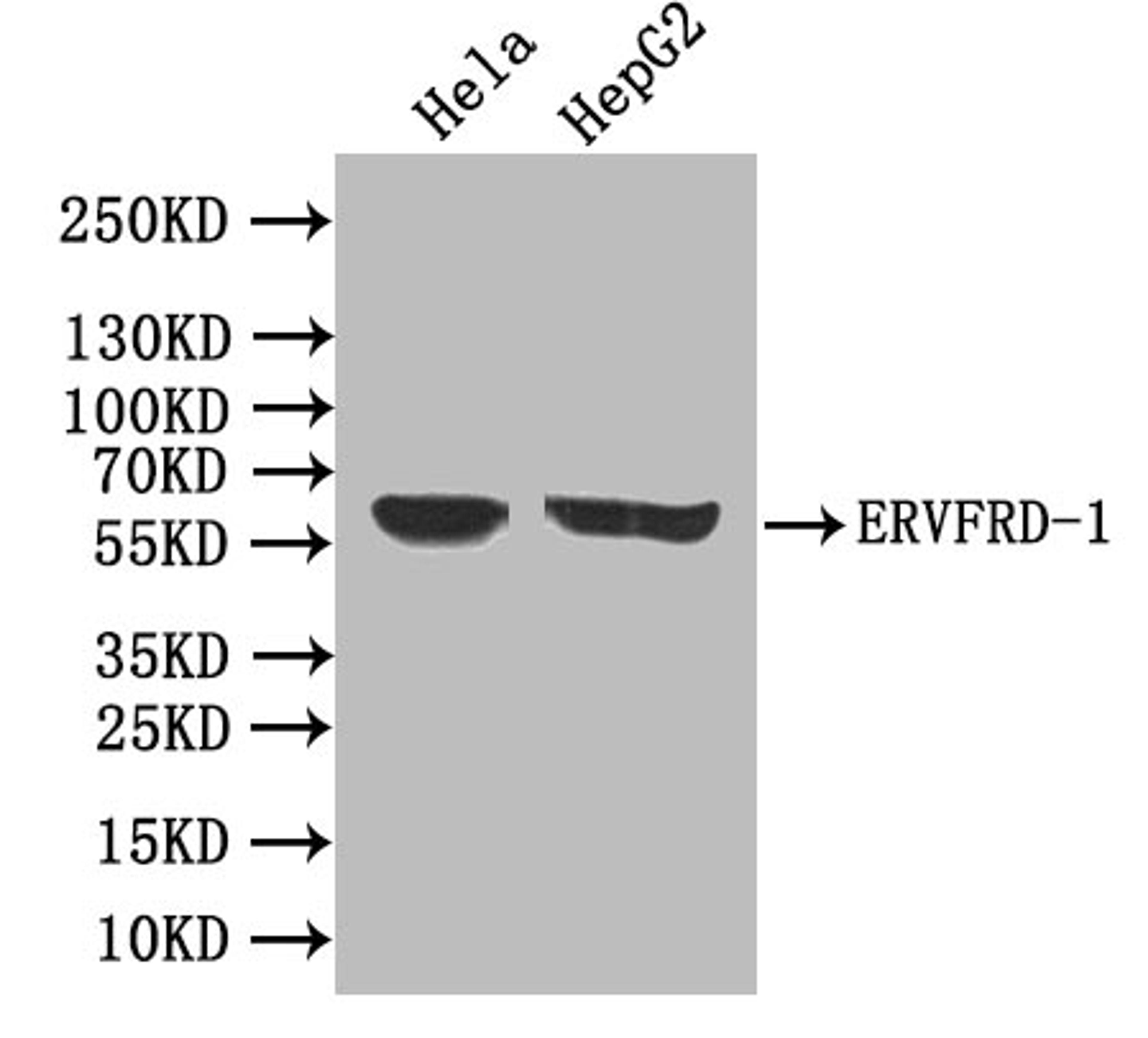 Western blot. All lanes: ERVFRD-1 antibody at 3.93ug/ml. Lane 1: Hela whole cell lysate. Lane 2: HepG2 whole cell lysate. Lane 3: A431 whole cell lysate. Secondary. Goat polyclonal to rabbit IgG at 1/10000 dilution. Predicted band size: 60 kDa. Observed band size: 60 kDa.