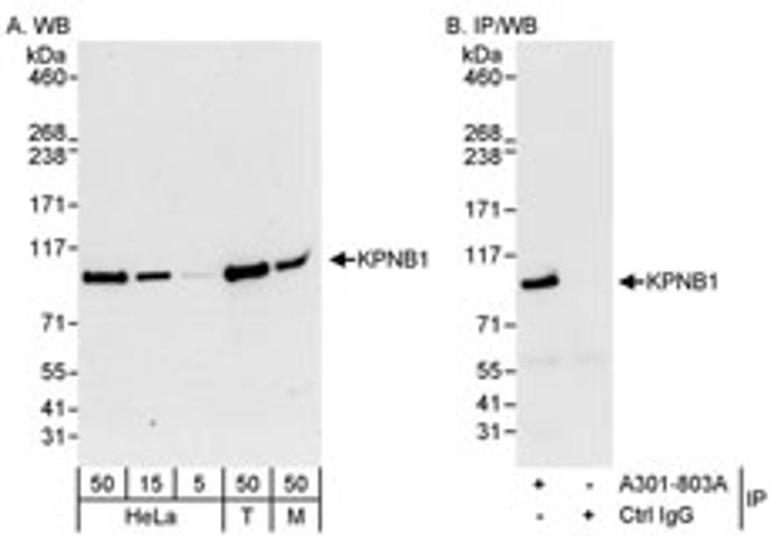 Detection of human and mouse KPNB1 by western blot (h&m) and immunoprecipitation (h).