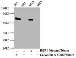 Western Blot. Positive WB detected in 293 whole cell lysate锛孉549 whole cell lysate(treated with Calyculin A or EGF). All lanes Phospho-PRKAA2 antibody at 1.95μg/ml. Secondary. Goat polyclonal to rabbit IgG at 1/50000 dilution. Predicted band size: 62 KDa. Observed band size: 62 KDa.