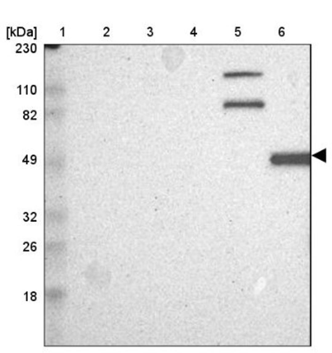 Western Blot: Calpain 10 Antibody [NBP1-87489] - Lane 1: Marker [kDa] 230, 110, 82, 49, 32, 26, 18<br/>Lane 2: Human cell line RT-4<br/>Lane 3: Human cell line U-251MG sp<br/>Lane 4: Human plasma (IgG/HSA depleted)<br/>Lane 5: Human liver tissue<br/>Lane 6: Human tonsil tissue