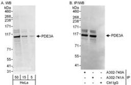 Detection of human PDE3A by western blot and immunoprecipitation.