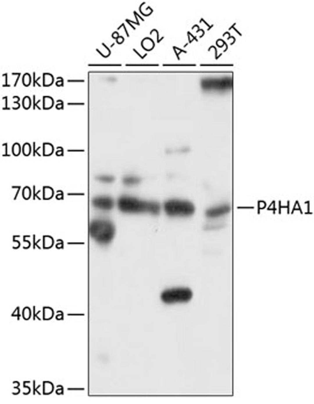 Western blot - P4HA1 antibody (A10538)