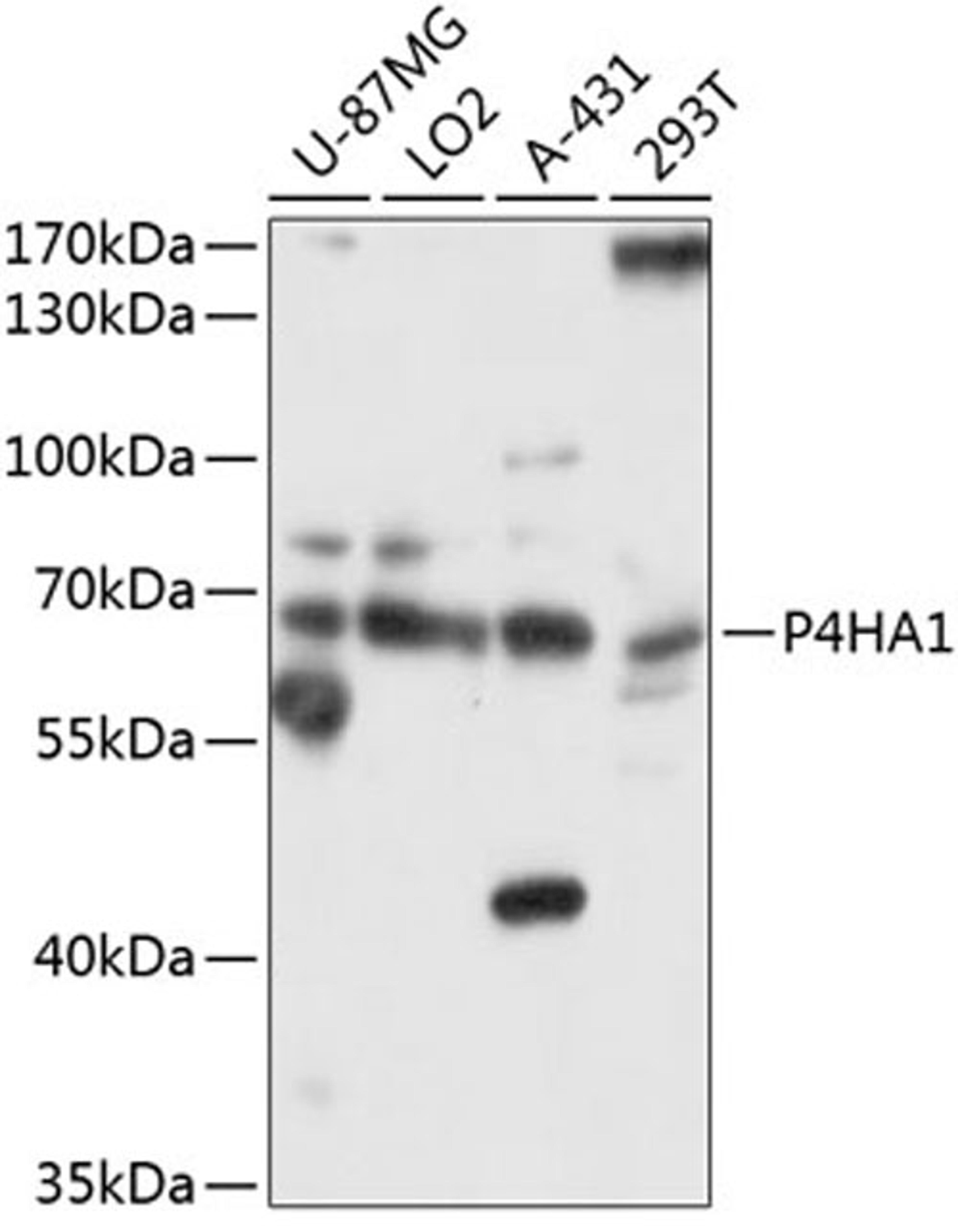 Western blot - P4HA1 antibody (A10538)