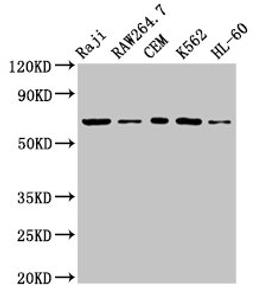 Western Blot. Positive WB detected in: Raji whole cell lysate, RAW264.7 whole cell lysate, CEM whole cell lysate, K562 whole cell lysate, HL60 whole cell lysate. All lanes: Zap70 antibody at 3.2µg/ml. Secondary. Goat polyclonal to rabbit IgG at 1/50000 dilution. Predicted band size: 71, 36 kDa. Observed band size: 71 kDa