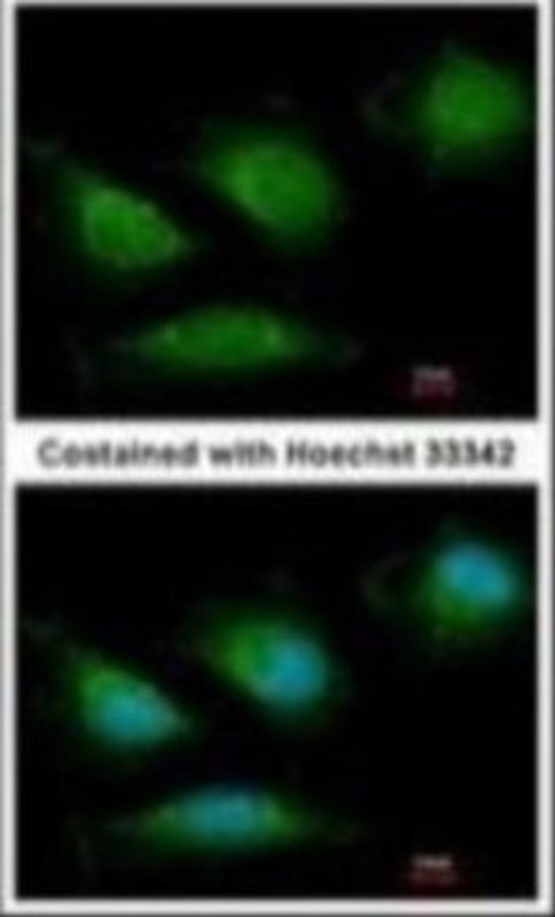 Immunocytochemistry/Immunofluorescence: DNA Polymerase gamma Antibody [NBP1-52300] - Analysis of anti-POLG antibody with methanol-fixed HeLa cell at 1:200 dilution.