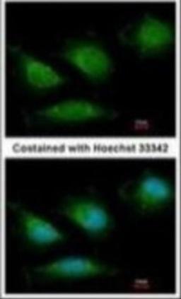 Immunocytochemistry/Immunofluorescence: DNA Polymerase gamma Antibody [NBP1-52300] - Analysis of anti-POLG antibody with methanol-fixed HeLa cell at 1:200 dilution.