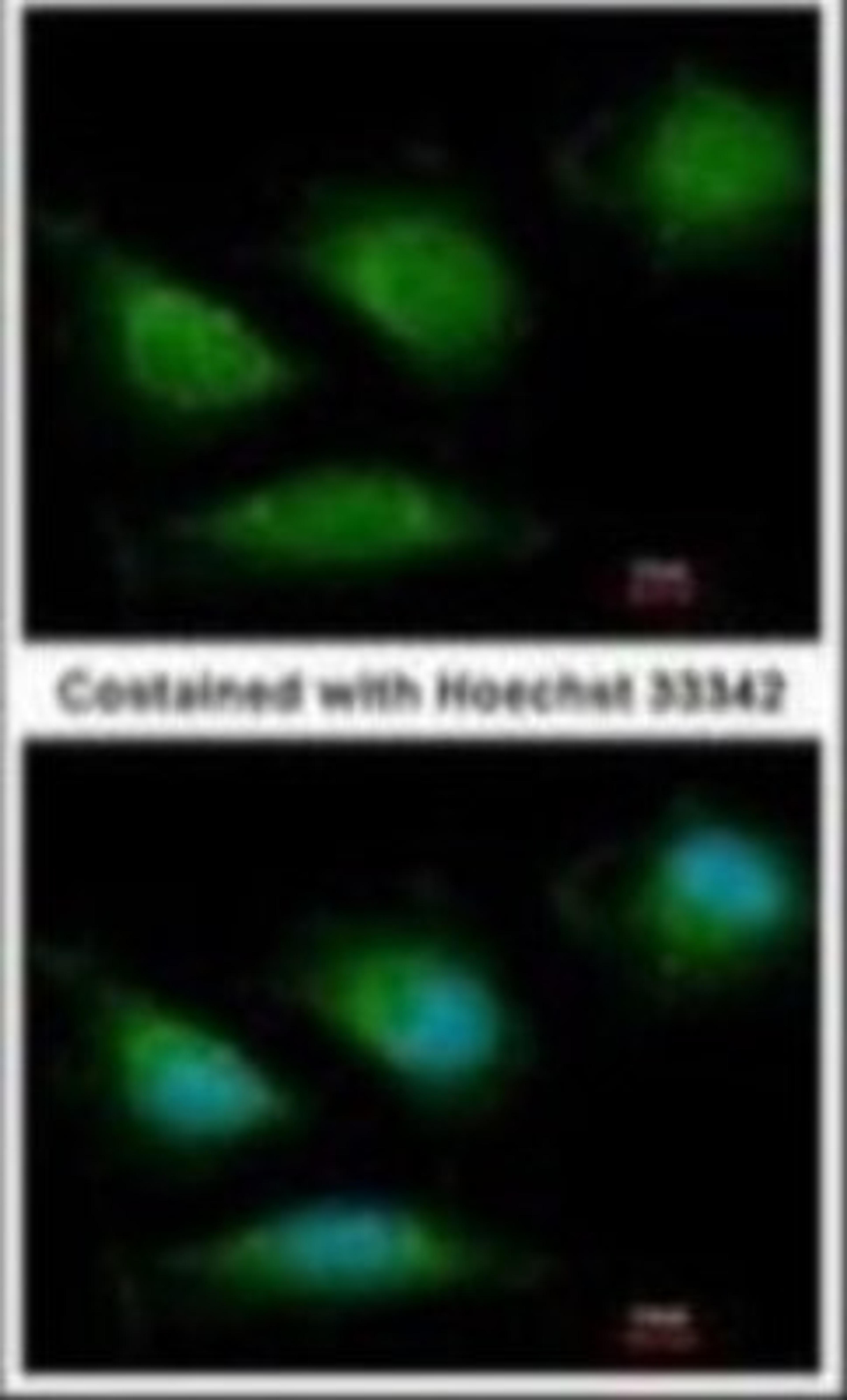 Immunocytochemistry/Immunofluorescence: DNA Polymerase gamma Antibody [NBP1-52300] - Analysis of anti-POLG antibody with methanol-fixed HeLa cell at 1:200 dilution.